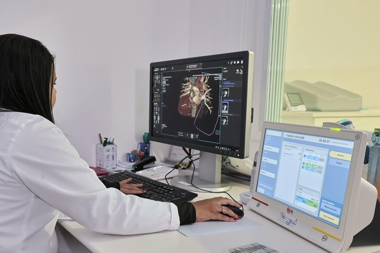 Tela de computador exibindo reconstrução 3D do coração e das artérias coronárias em angiotomografia