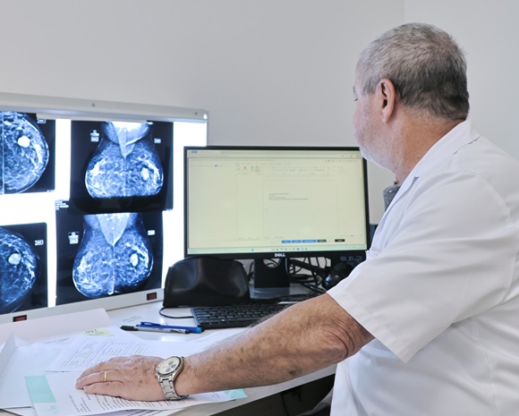 Médico analisa imagens de mamografia em estação de trabalho com monitor e negatoscópio na Lagos Scan, clínica de diagnóstico por imagem em Araruama/RJ