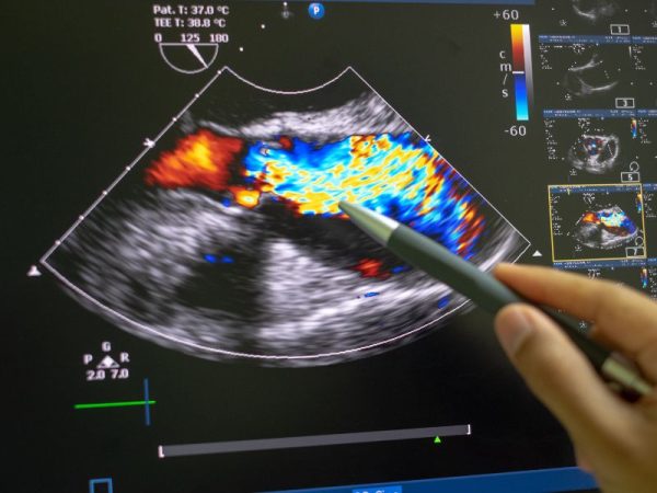 Médico analisando fluxo sanguíneo em exame de ultrassonografia com Doppler colorido na clínica Lagos Scan em Araruama.