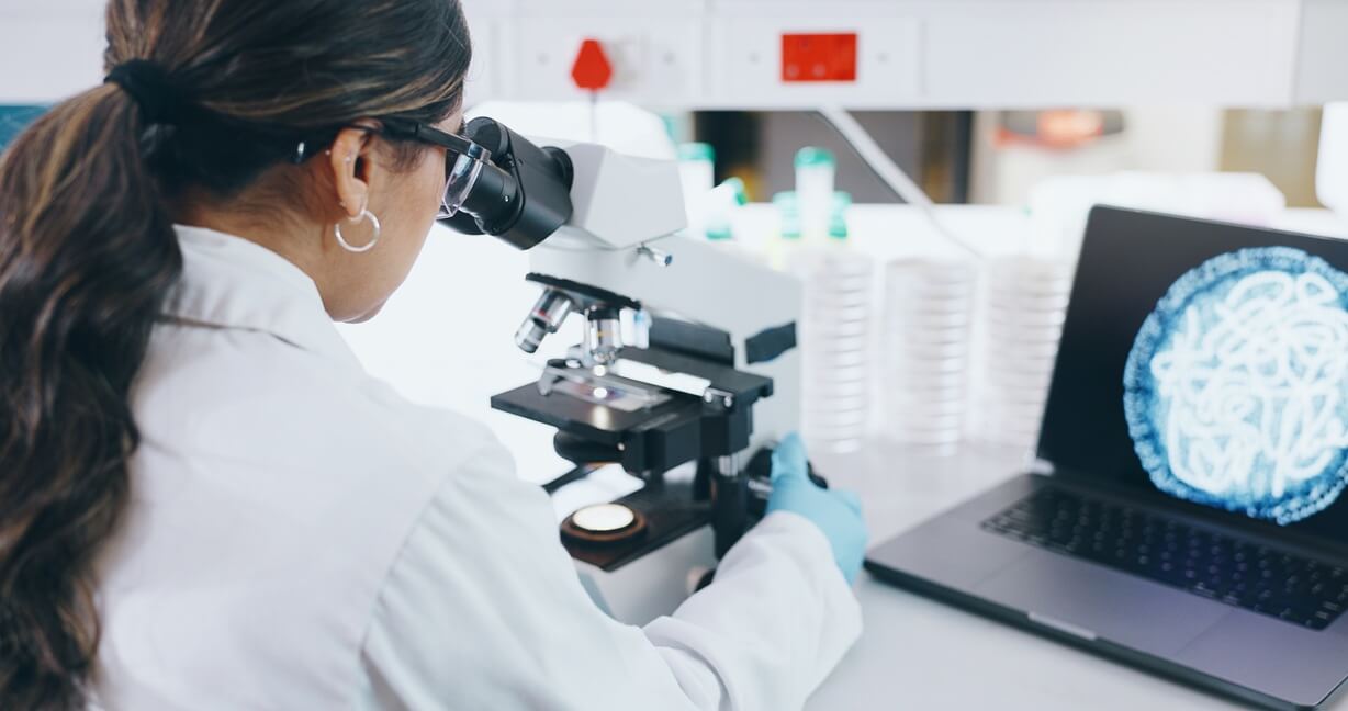 Médica patologista utilizando microscópio de alta precisão em laboratório para análise de amostra de biópsia mamária