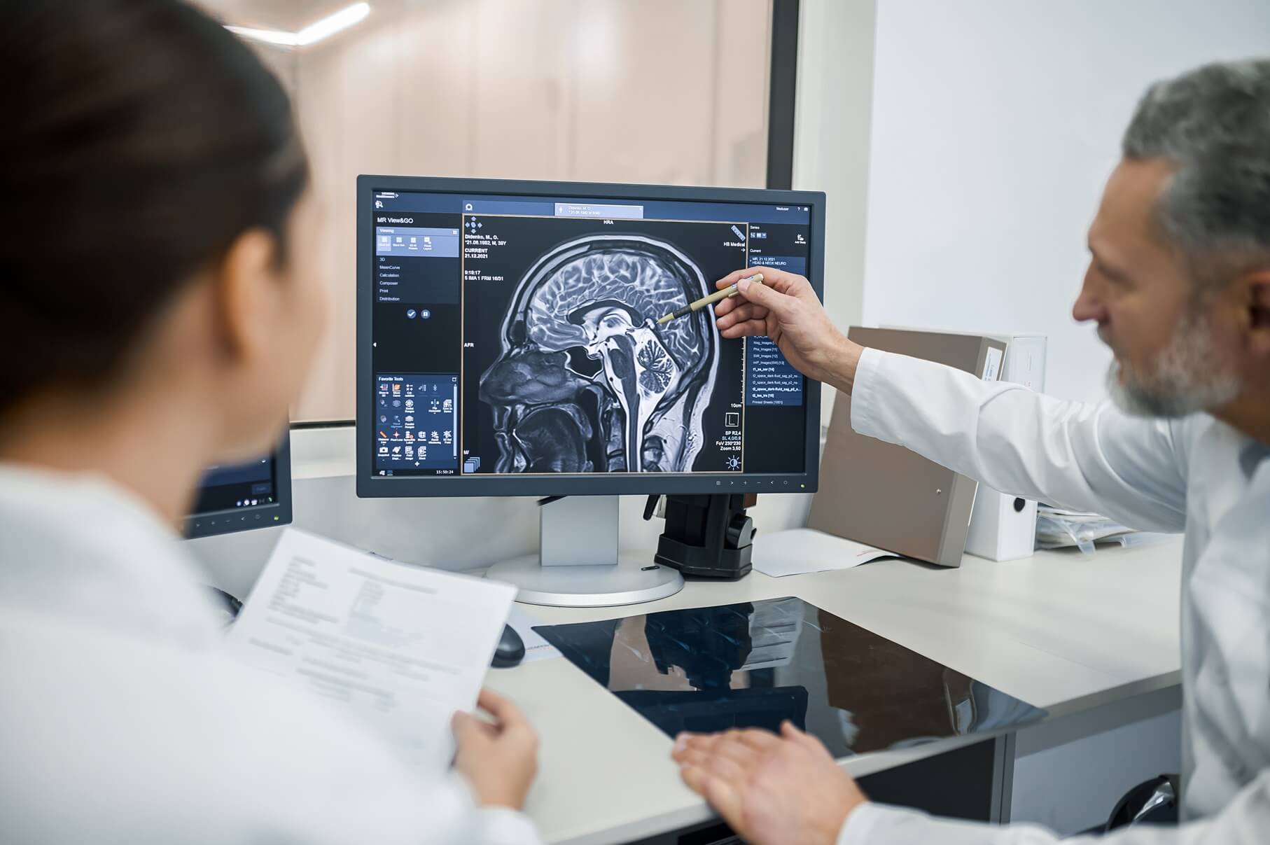 Médicos radiologistas analisando imagem detalhada de neuroimagem e vasos cerebrais em estação de trabalho moderna.